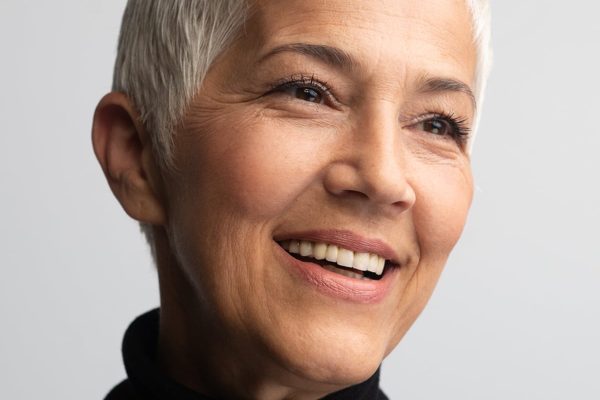 An Older Woman With Youthful Sin After Microchanneling Treatment
