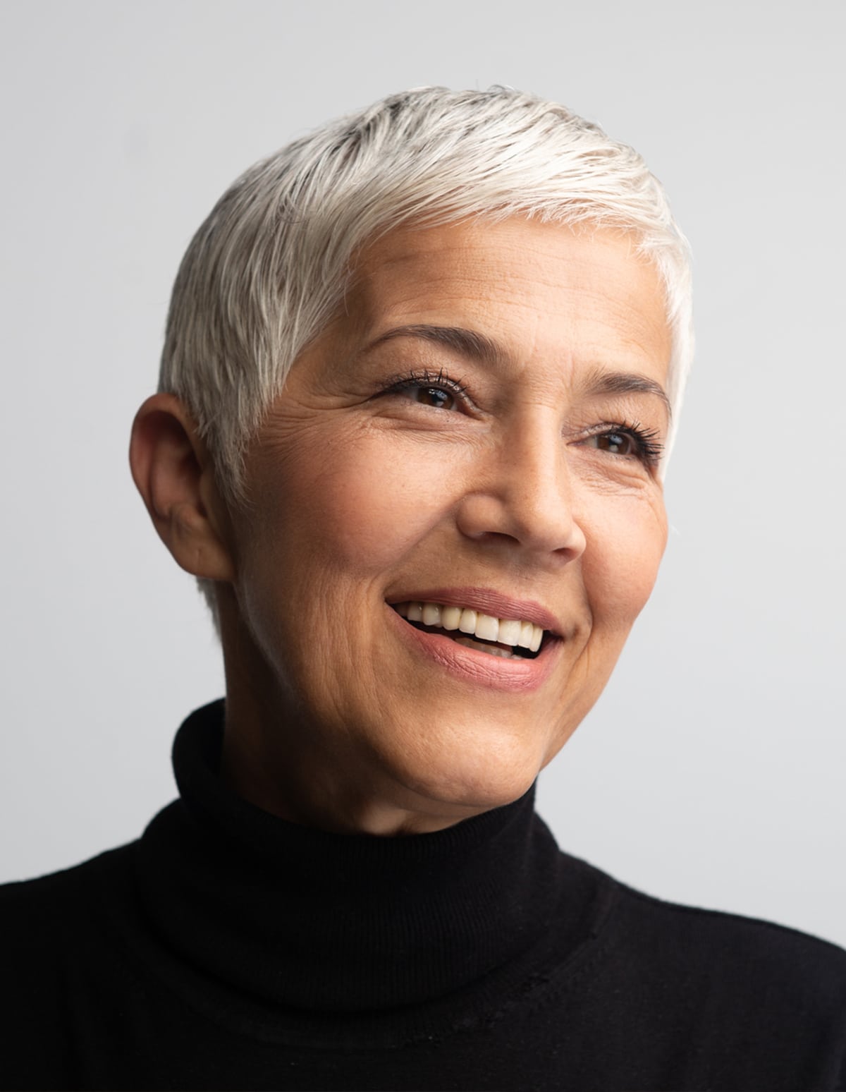 An older woman with youthful sin after microchanneling treatment